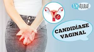 Candidíase Vaginal: o que é, sintomas, diagnóstico, tratamento e prevenção