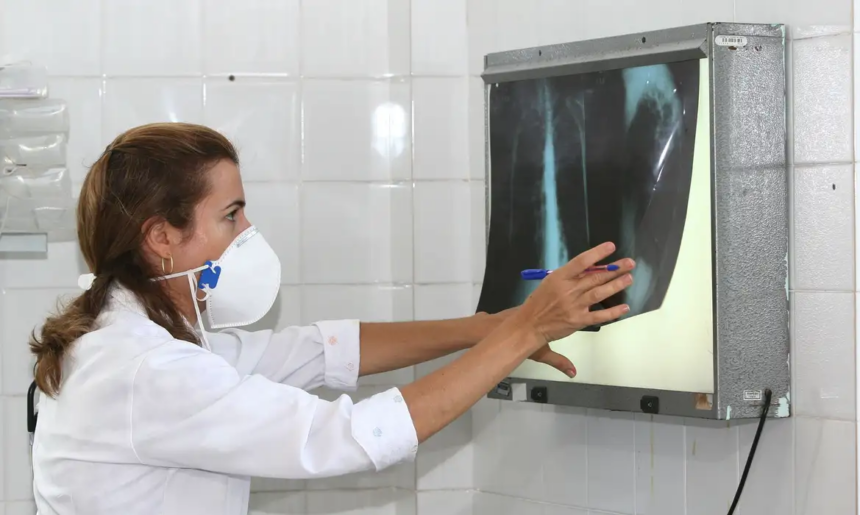 Tuberculose: Amazonas lidera incidência no Brasil, seguido por Roraima e Rio de Janeiro Tuberculose: Amazonas lidera incidência no Brasil, seguido por Roraima e Rio de Janeiro