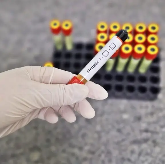 Período chuvoso pede mais atenção contra a dengue – Portal Goiás Período chuvoso pede mais atenção contra a dengue – Portal Goiás