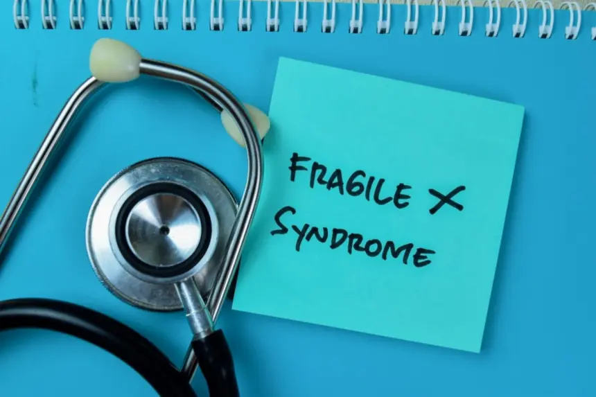 Síndrome do X Frágil: conheça as causas e os sintomas