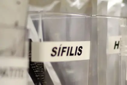 Centro de SP tem testagem grátis de HIV, hepatite, síflis e gonorreia
